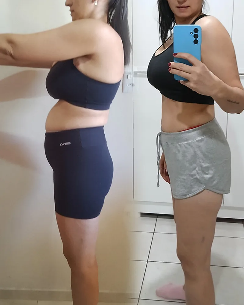 Antes e depois — Maria Ferreira